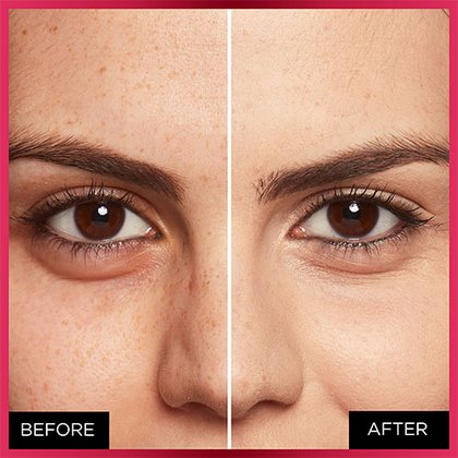 OAP MAKEUP FACE MTC BEFORE AFTER 322