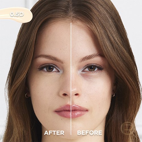 Before After 05D