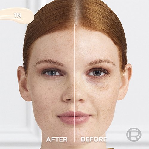 Before After 1N