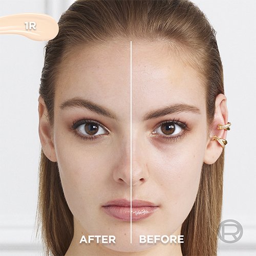 Before After 1R