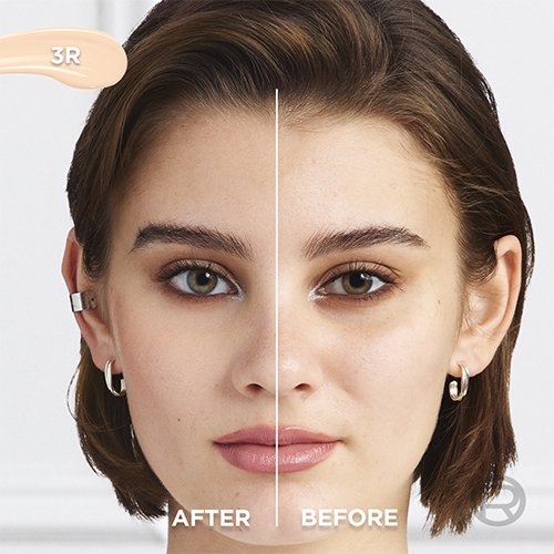 Before After 3R