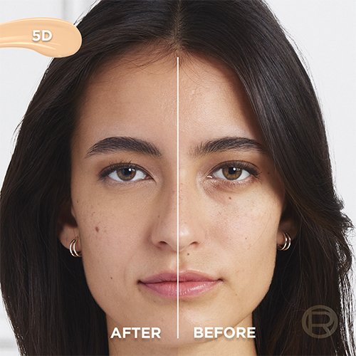 Before After 5D