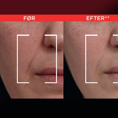 LOP NORDIC Revitalift Laser BA Banner 2026 940x705px