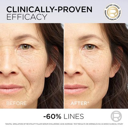 04102026 Oap Revitalift Filler Hyaluronic Acid Pdrn Serum Before After Dmi Website
